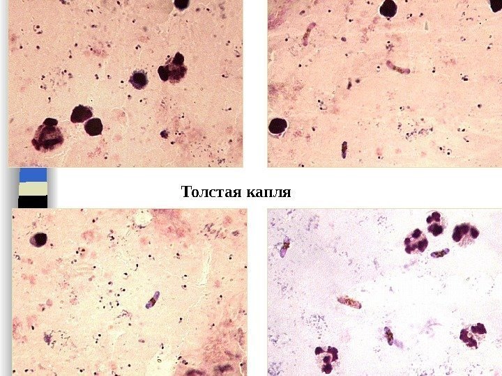 Толстая капля 